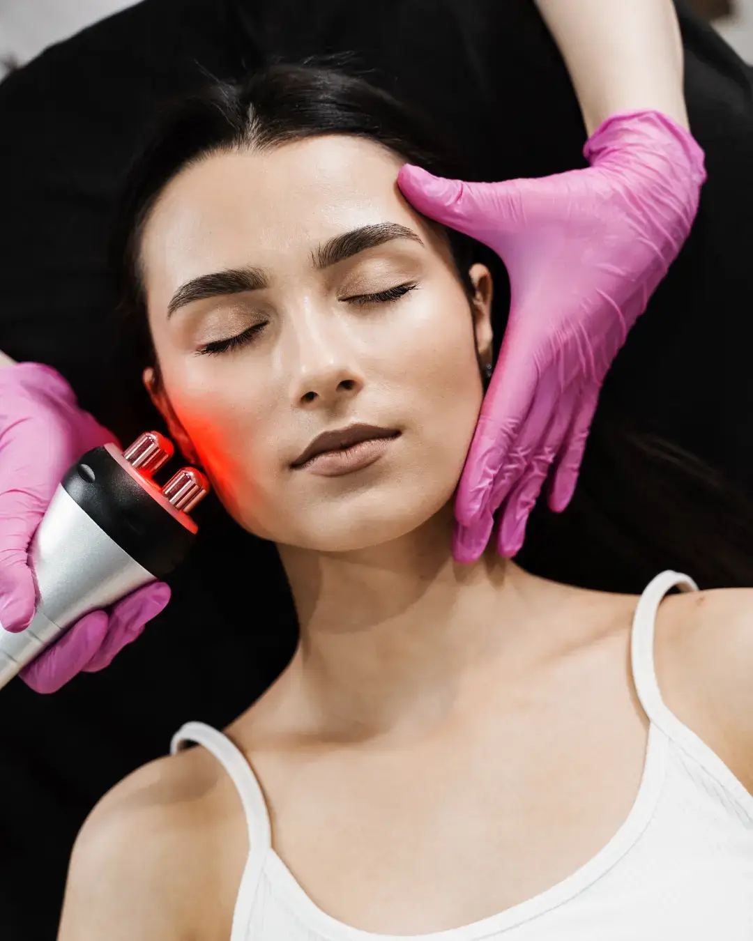 Как протича RF лифтинг процедурата