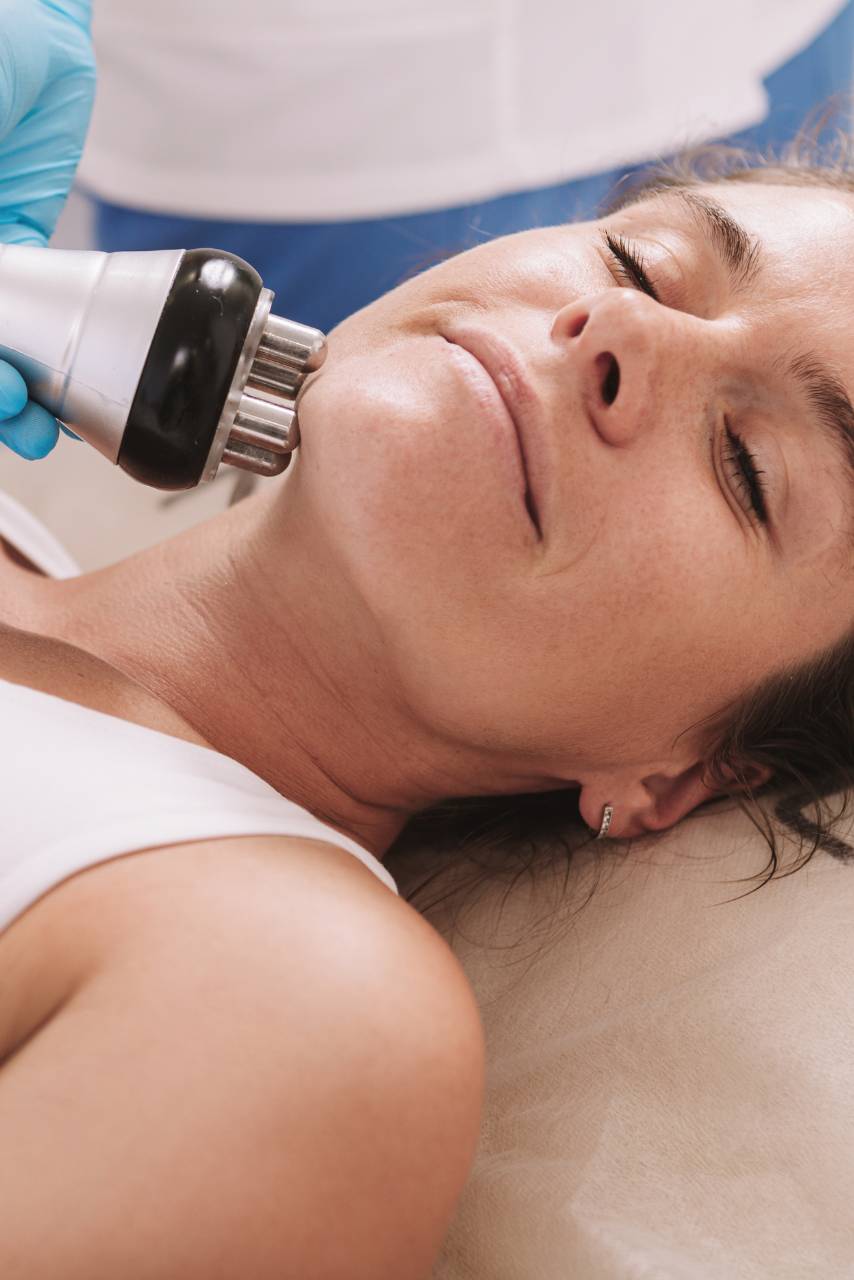 Предимства на радиочестотния лифтинг