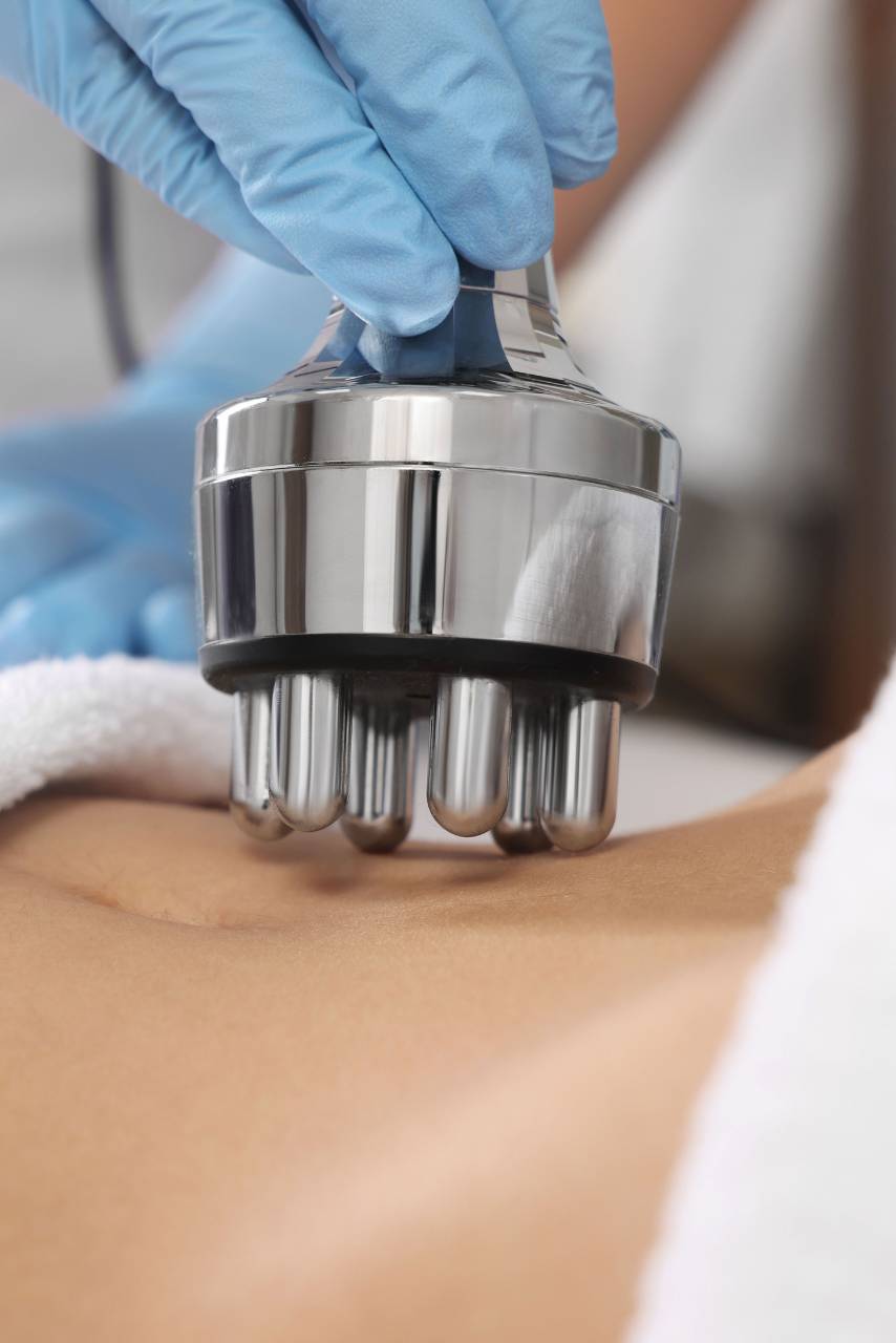 Подготовка за RF лифтинг